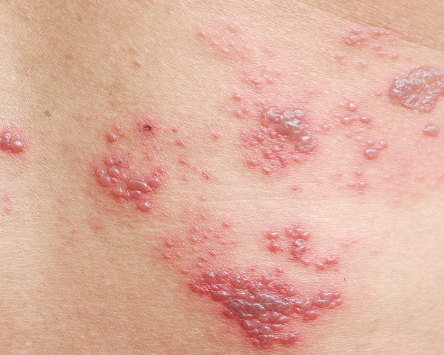 Home Banner Shingles PR