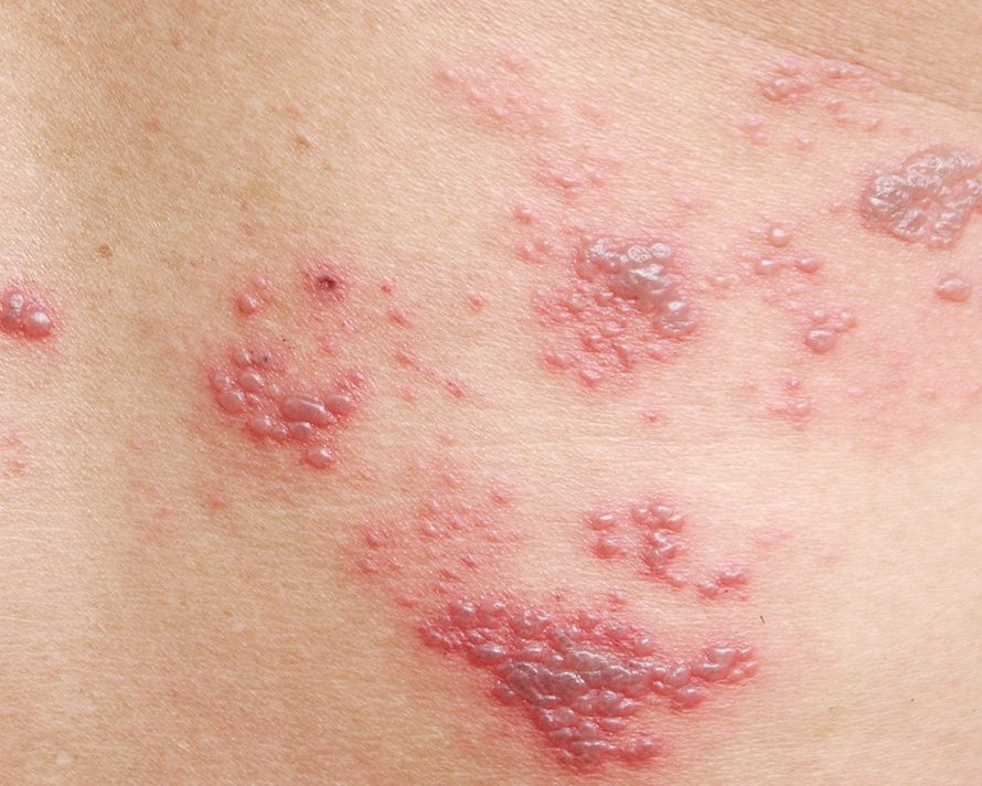 Home Banner Shingles PR