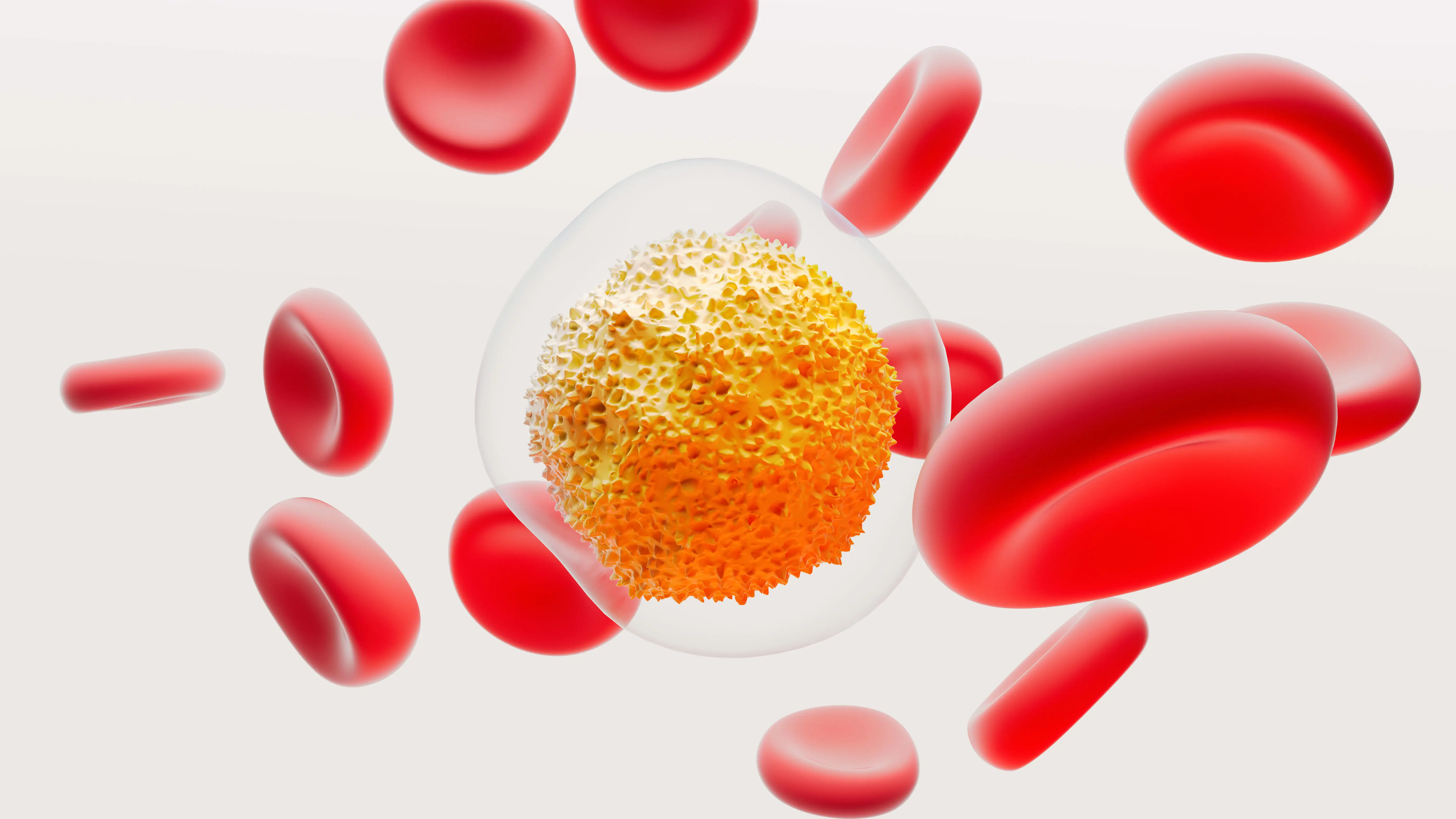 Multiple myeloma octane